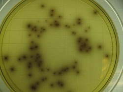 Understanding the growth conditions of Listeria monocytogenes is the first step towards controlling the pathogen.