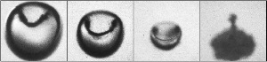 Photomicrograph of an imploding cavitation bubble